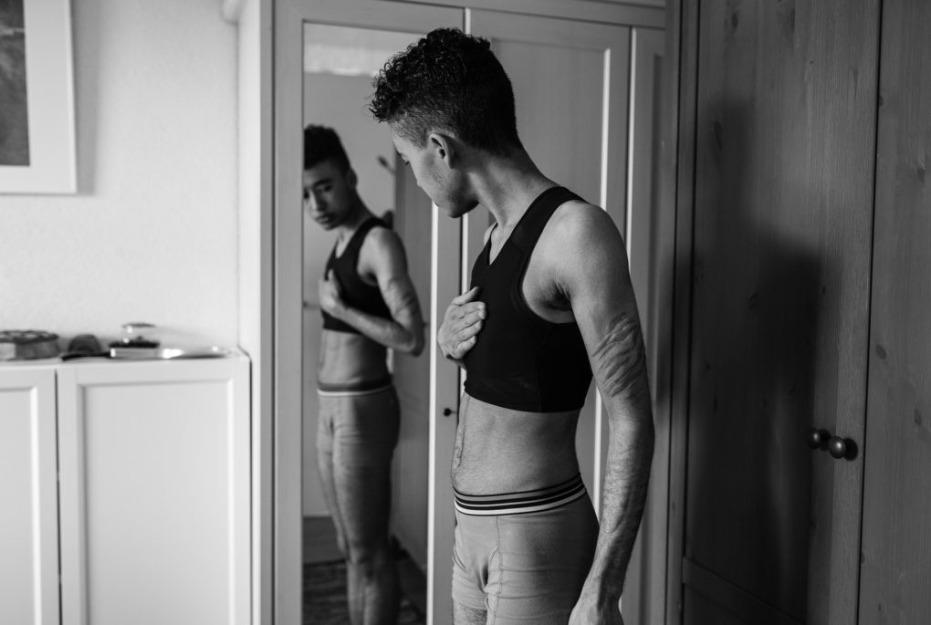 Het voelt niet alsof mijn borsten op mijn lichaam horen