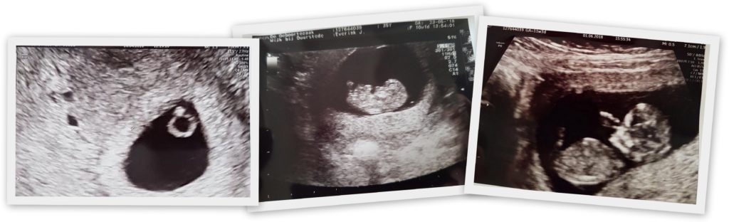 echo EERSTE TRIMESTER